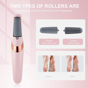 Electric Foot Callus Remover – 2 Speeds, USB Rechargeable, LED Light, Wet/Dry with Replaceable Heads