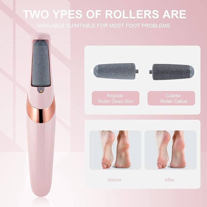 Electric Foot Callus Remover – 2 Speeds, USB Rechargeable, LED Light, Wet/Dry with Replaceable Heads