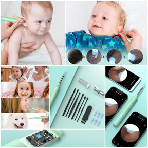 1080P Wireless Ear Wax Removal Tool with HD Camera, LED Lights & 7-Piece Accessory Kit