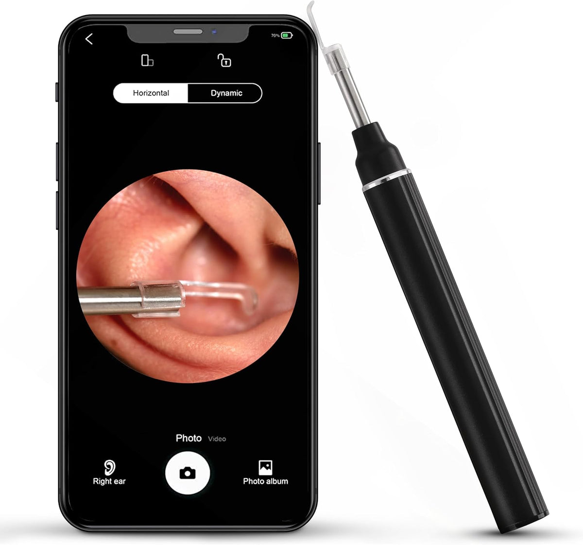 Close-up of a smartphone displaying a clear view of the inside of an ear, with a black and silver otoscope tool positioned next to it. The screen shows a zoomed-in image of the ear canal.