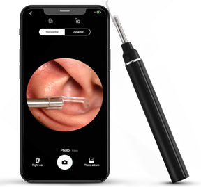 Close-up of a smartphone displaying a clear view of the inside of an ear, with a black and silver otoscope tool positioned next to it. The screen shows a zoomed-in image of the ear canal.